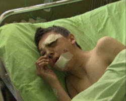 A boy wounded in the bombardment of the Belgrade hospital